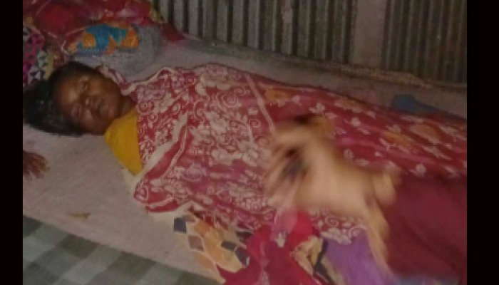 সুন্দরগঞ্জে কুকুরের কামড়ে মৃত ৫: আহত ১২